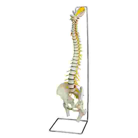 &quot;Spine with Slipped Disc&quot; Anatomy Model
