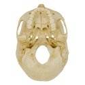 "4-Part Skull – Standard" Anatomy Model