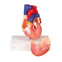 Erler Zimmer "Heart" Anatomy Model