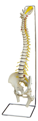 "Spine with Slipped Disc" Anatomy Model