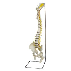 Spine with Slipped Disc / Anatomical Model